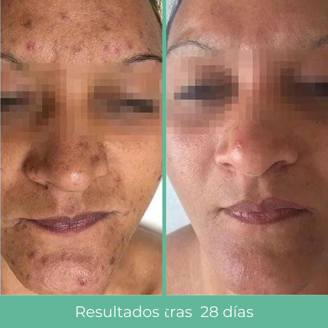 RUTINA PURIFYING PARA PIEL GRASA